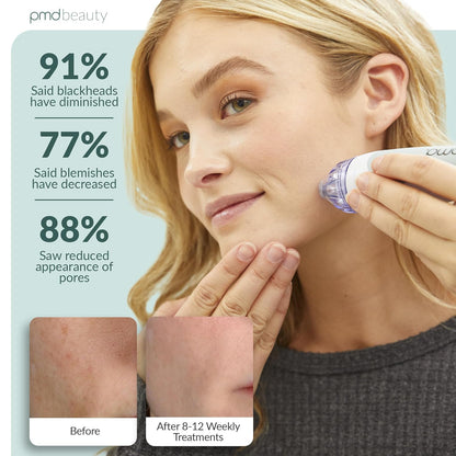 DarmaVue™ Portable Microderm Facial Exfoliator Kit